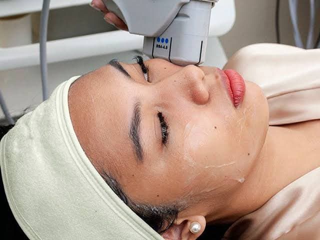 Facial HIFU Therapy